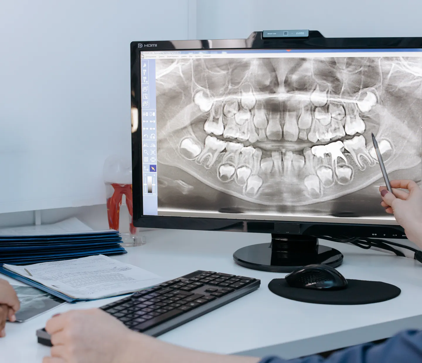 A dentist reviewing a 3D scan on screen